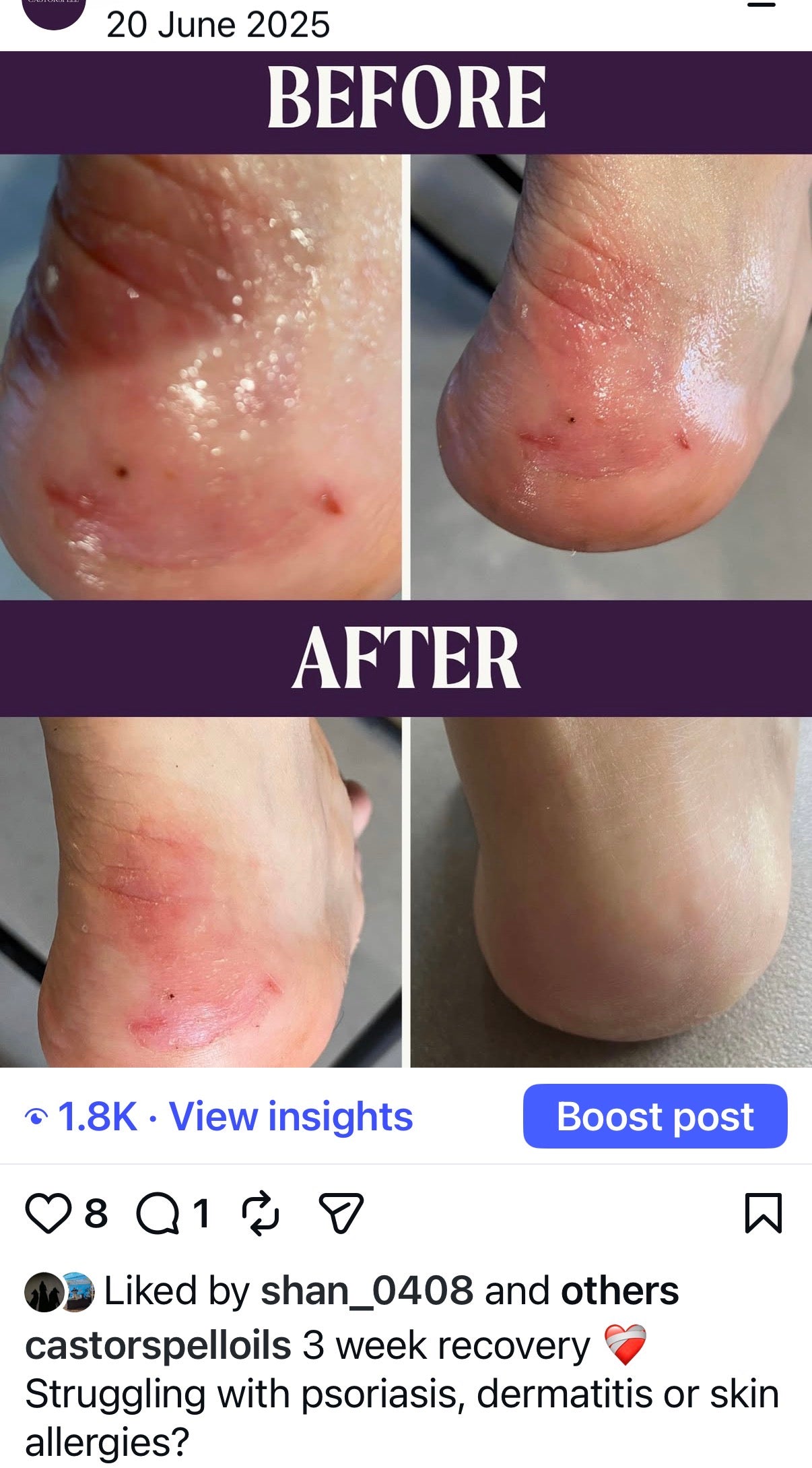face serum strawberry oil castor oil castor oil for face castor oil skincare castor oil benefits castor oil organic meno peace oil comfort oil endo oil cycle relief perimenopause oil hormone oil